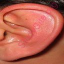 ear (Oops! image not found)